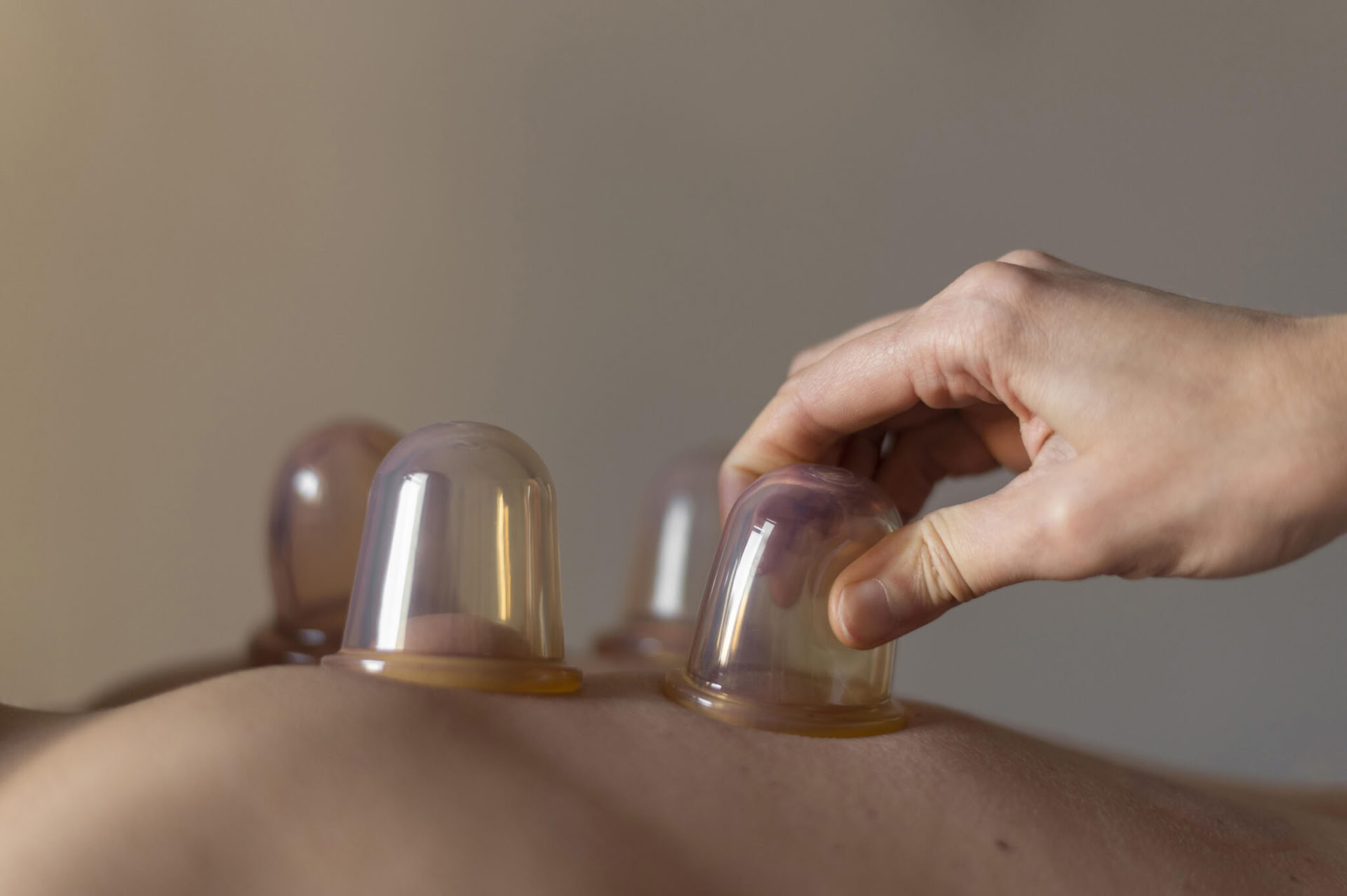 Schröpfmassage