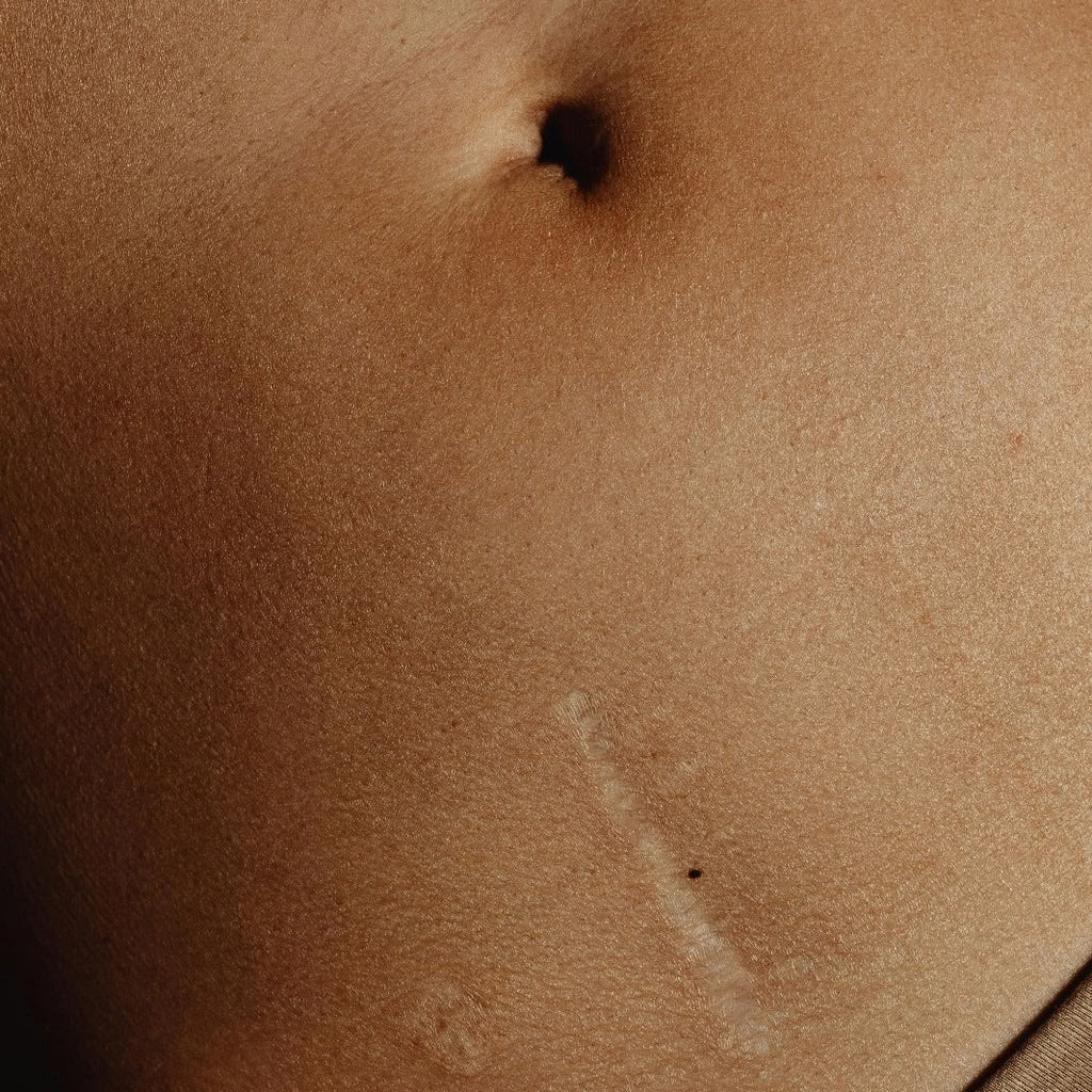 Abdominal Womb Healing Training 2026
