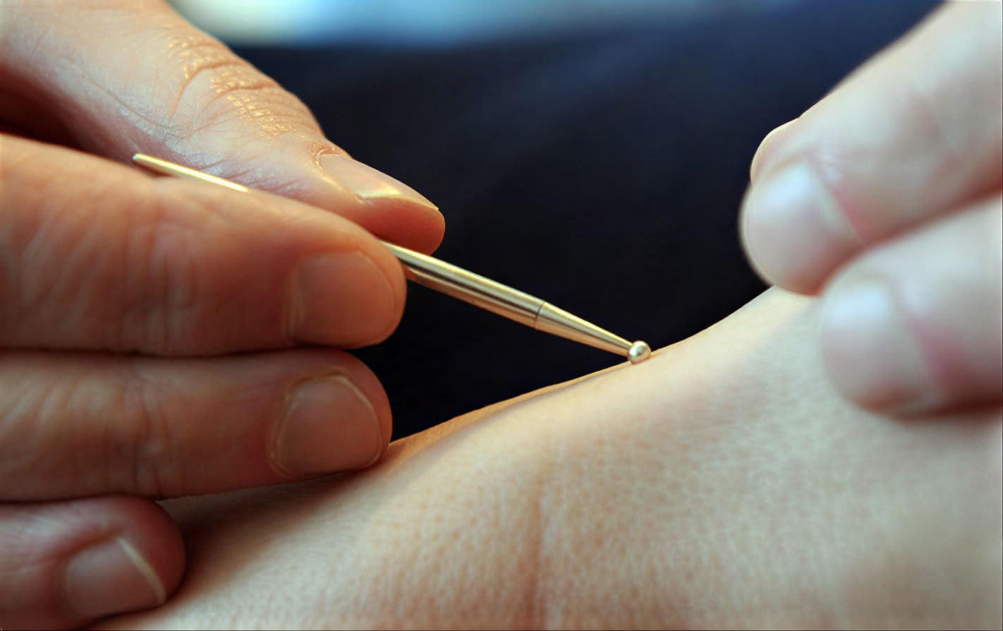 Nährendes Leben LA • Akupunktur & Chinesische Medizin